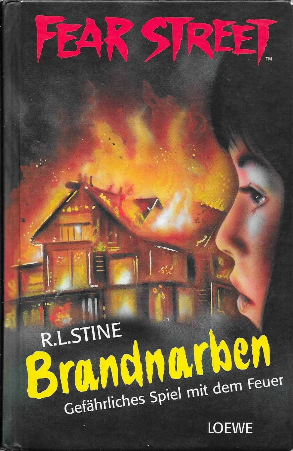 Brandnarben: Gefährliches Spiel mit dem Feuer